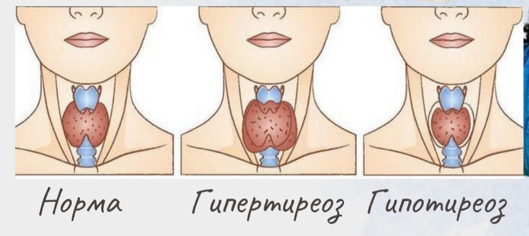 Диагностика щитовидной железы